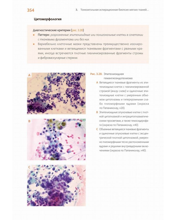 Практическая цитопатология. Интерпретация результатов ТИАБ на основе распознавания паттернов. В 2 т. Т. 2