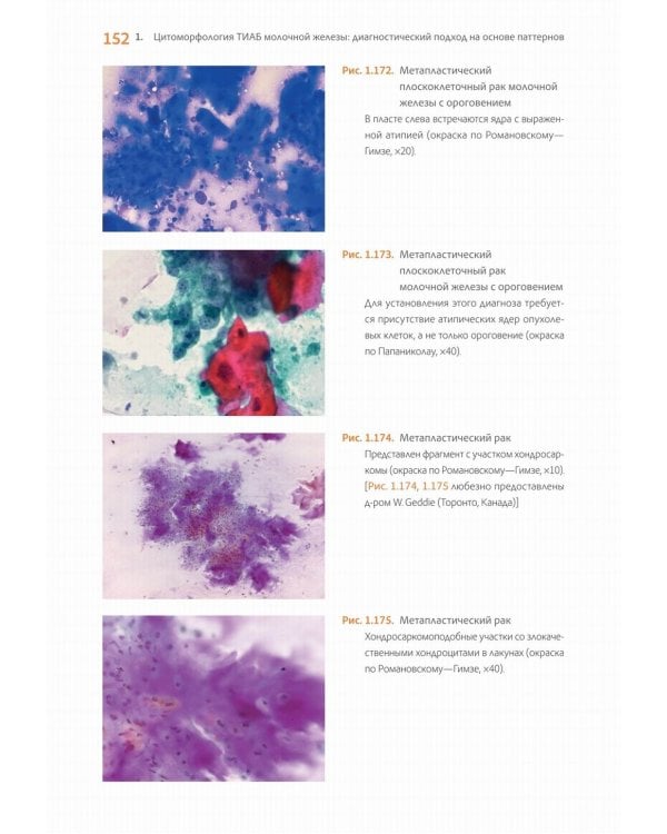 Практическая цитопатология. Интерпретация результатов ТИАБ на основе распознавания паттернов. В 2 т. Т. 2