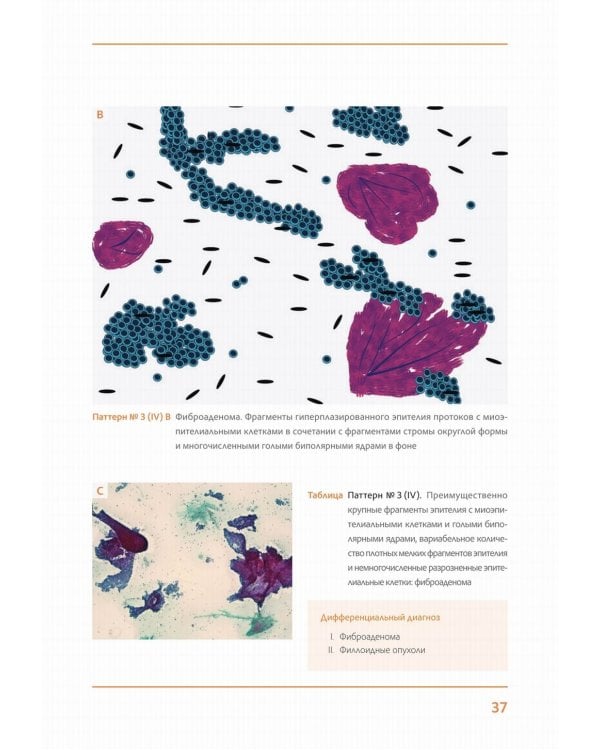 Практическая цитопатология. Интерпретация результатов ТИАБ на основе распознавания паттернов. В 2 т. Т. 2