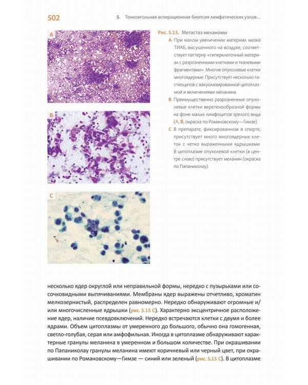 Практическая цитопатология. Интерпретация результатов ТИАБ на основе распознавания паттернов. В 2 т. Т. 2