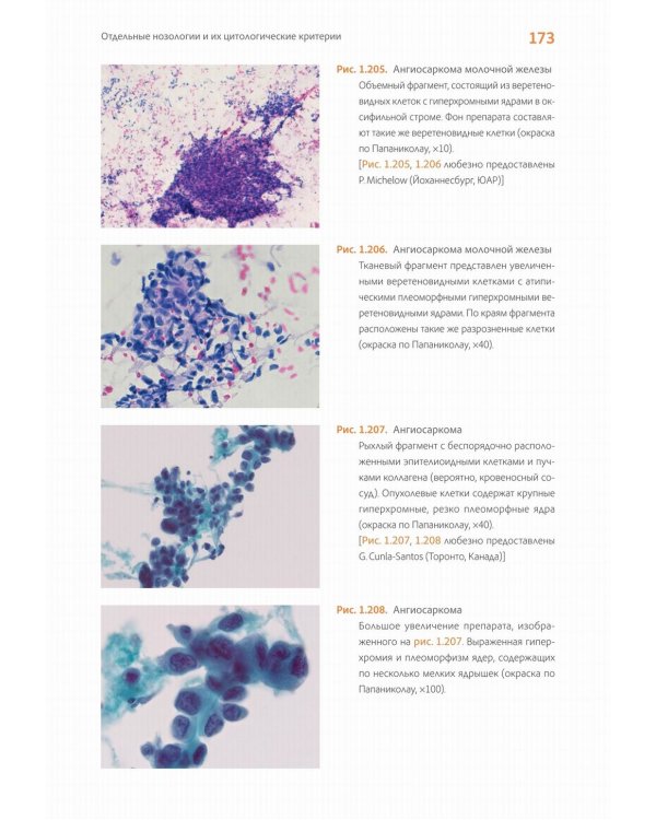 Практическая цитопатология. Интерпретация результатов ТИАБ на основе распознавания паттернов. В 2 т. Т. 2