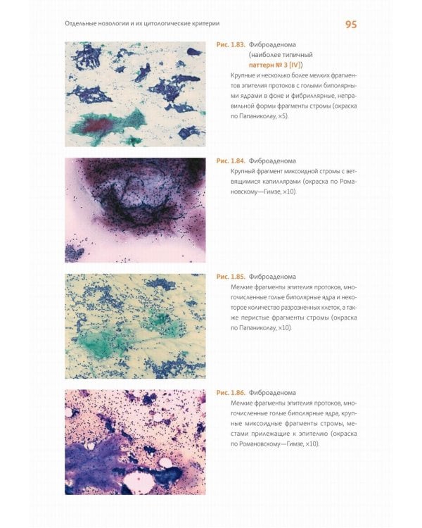 Практическая цитопатология. Интерпретация результатов ТИАБ на основе распознавания паттернов. В 2 т. Т. 2