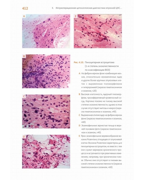 Практическая цитопатология. Интерпретация результатов ТИАБ на основе распознавания паттернов. В 2 т. Т. 2