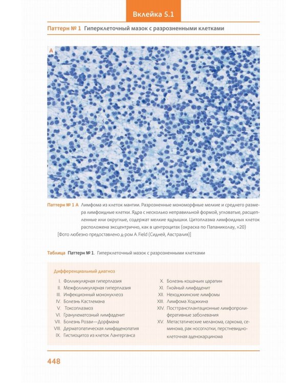 Практическая цитопатология. Интерпретация результатов ТИАБ на основе распознавания паттернов. В 2 т. Т. 2