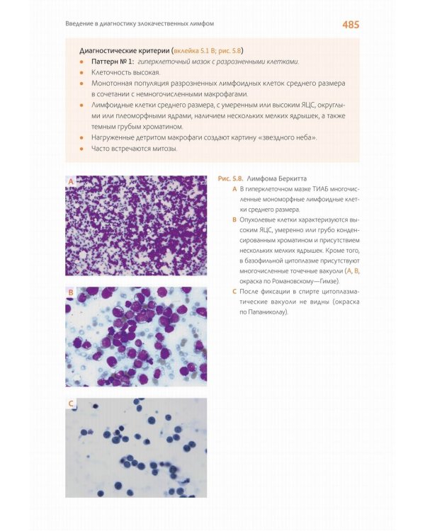 Практическая цитопатология. Интерпретация результатов ТИАБ на основе распознавания паттернов. В 2 т. Т. 2