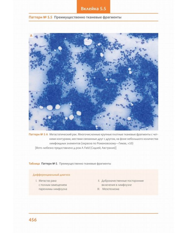Практическая цитопатология. Интерпретация результатов ТИАБ на основе распознавания паттернов. В 2 т. Т. 2