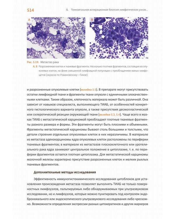 Практическая цитопатология. Интерпретация результатов ТИАБ на основе распознавания паттернов. В 2 т. Т. 2