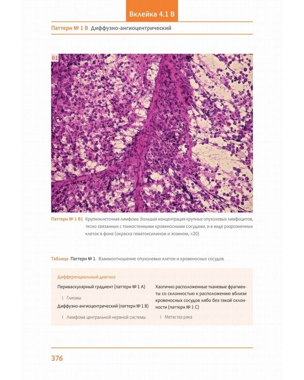 Практическая цитопатология. Интерпретация результатов ТИАБ на основе распознавания паттернов. В 2 т. Т. 2