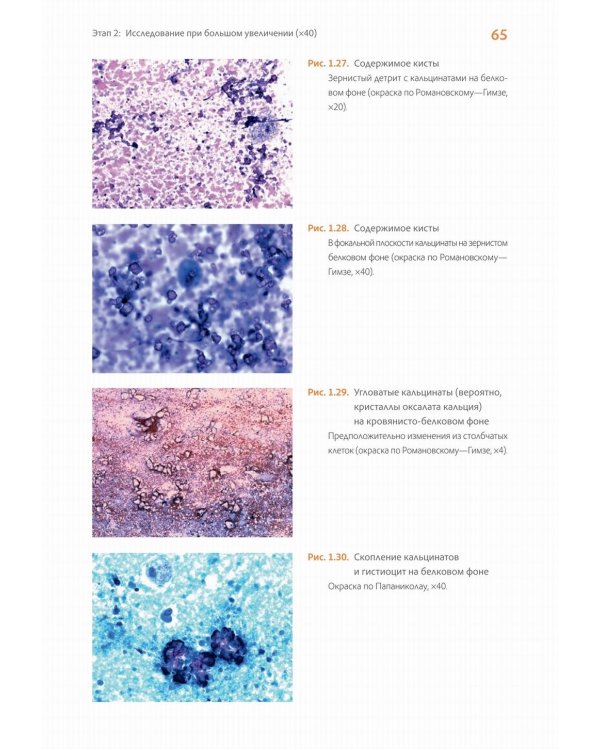 Практическая цитопатология. Интерпретация результатов ТИАБ на основе распознавания паттернов. В 2 т. Т. 2