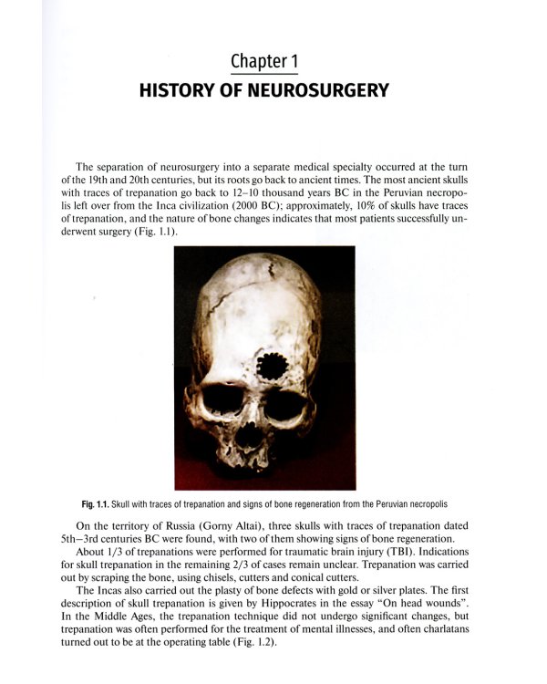 Neurology and neurosurgery = Неврология и нейрохирургия : textbook : in 2 vol.  Vol. 2. Neurosurg. 5-е изд., доп