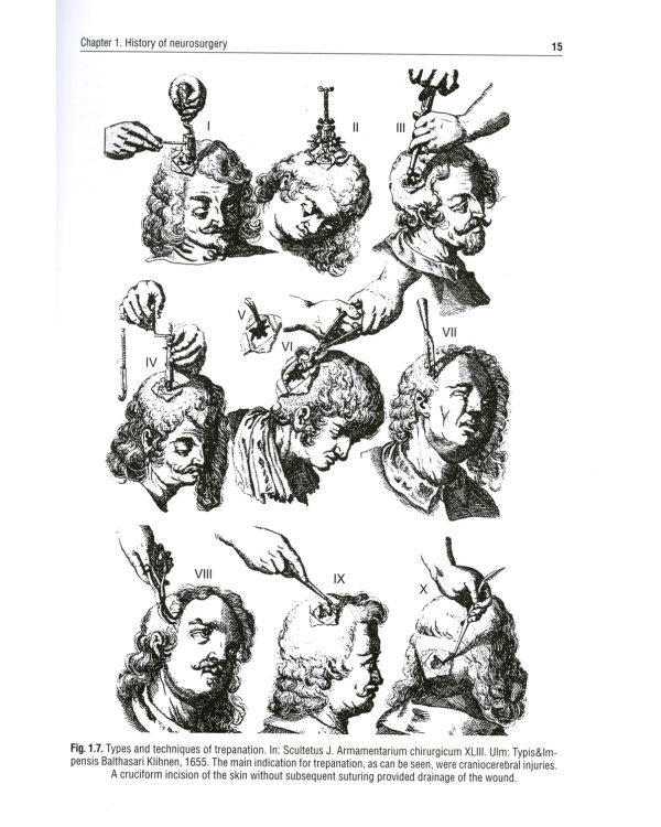 Neurology and neurosurgery = Неврология и нейрохирургия : textbook : in 2 vol.  Vol. 2. Neurosurg. 5-е изд., доп