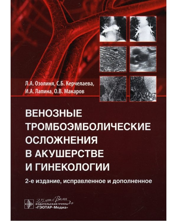 Венозные тромбоэмболические осложнения в акушерстве и гинекологии. 2-е изд., испр. и доп
