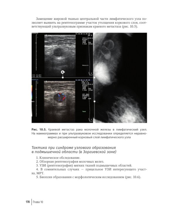 Атлас-путеводитель по медицинским изображениям молочной железы. Тестовые модули и контрольные задания