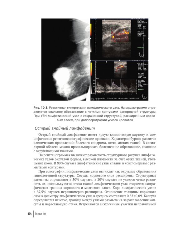 Атлас-путеводитель по медицинским изображениям молочной железы. Тестовые модули и контрольные задания