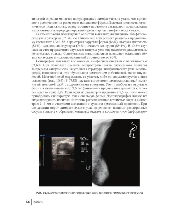 Атлас-путеводитель по медицинским изображениям молочной железы. Тестовые модули и контрольные задания