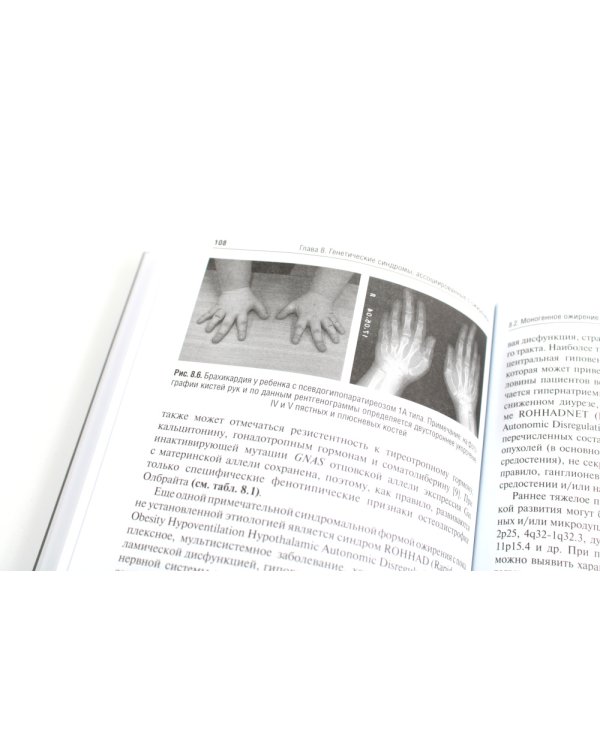 Ожирение у детей и подростков