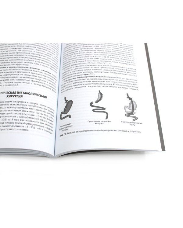 Ожирение у детей и подростков