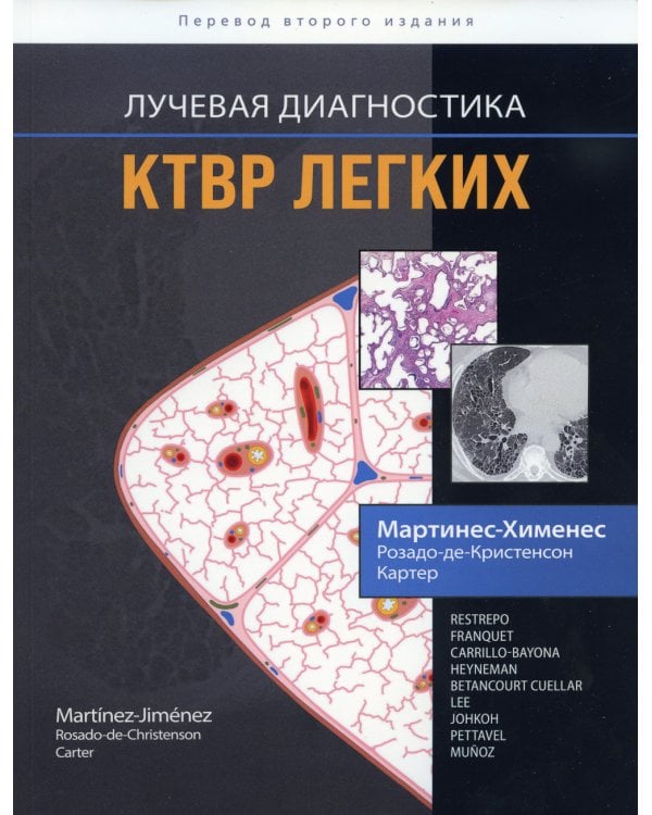 Лучевая диагностика. КТВР легких