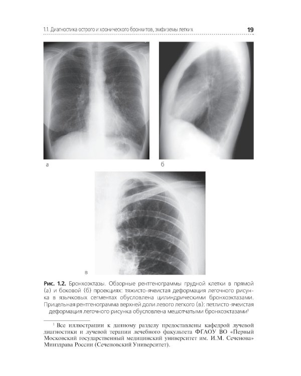 Диагностика терапевтических заболеваний: Учебник