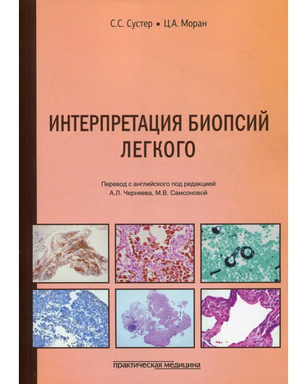 Интерпретация биопсий легкого