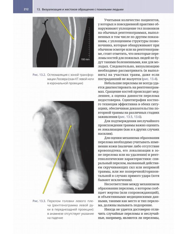 Судебно-медицинская радиология. От идентификации личности до посмертной визуализации