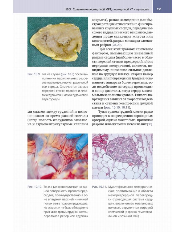 Судебно-медицинская радиология. От идентификации личности до посмертной визуализации