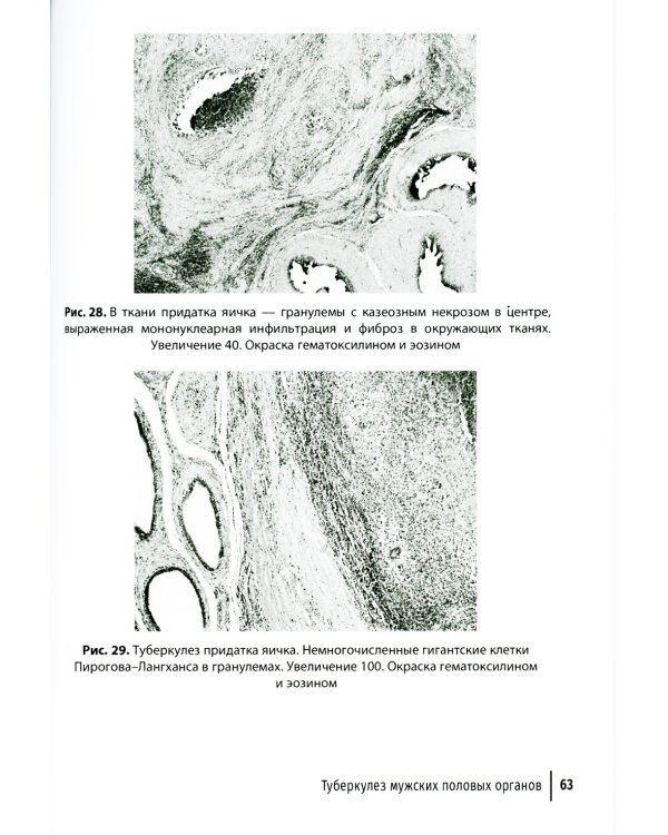 Туберкулез как заболевание, передающееся половым путем: руководство для врачей