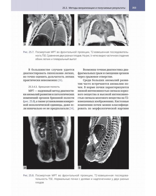 Судебно-медицинская радиология. От идентификации личности до посмертной визуализации