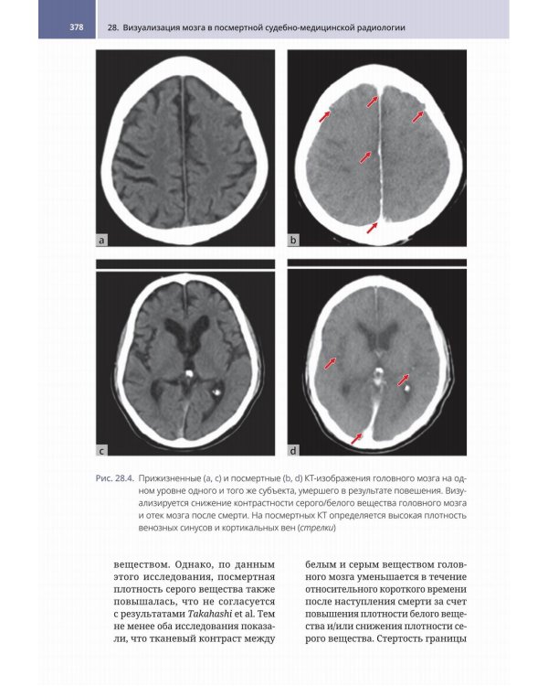 Судебно-медицинская радиология. От идентификации личности до посмертной визуализации