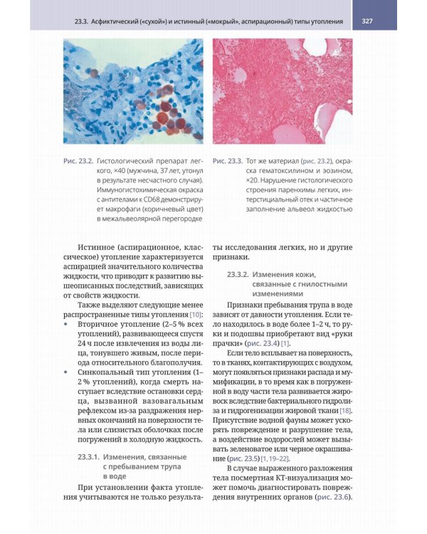 Судебно-медицинская радиология. От идентификации личности до посмертной визуализации