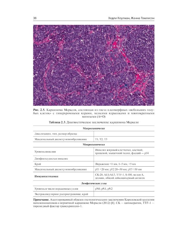 Немеланомные злокачественные новообразования кожи головы и шеи