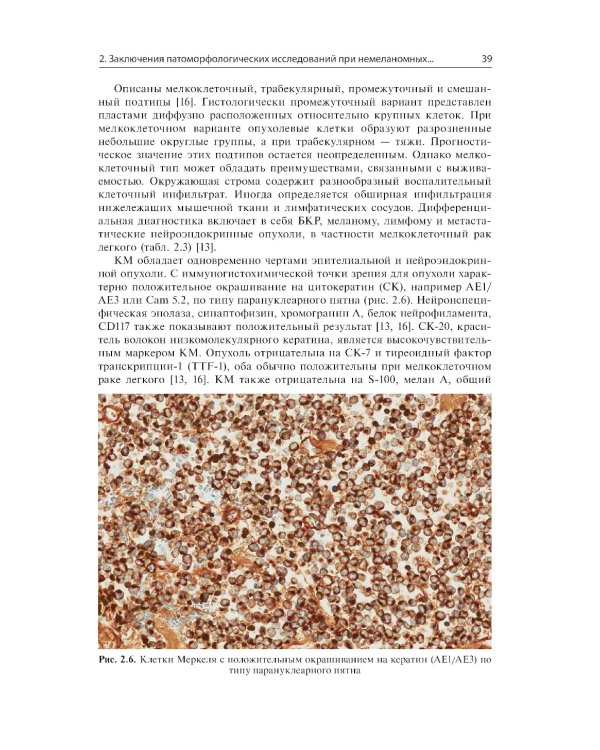 Немеланомные злокачественные новообразования кожи головы и шеи