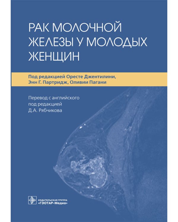 Рак молочной железы у молодых женщин