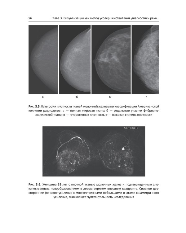 Рак молочной железы у молодых женщин