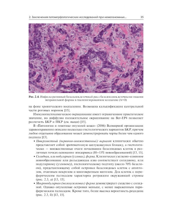 Немеланомные злокачественные новообразования кожи головы и шеи