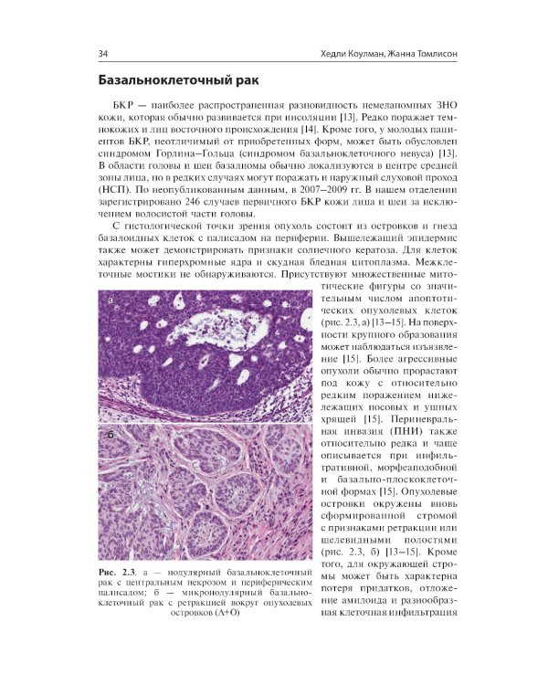 Немеланомные злокачественные новообразования кожи головы и шеи
