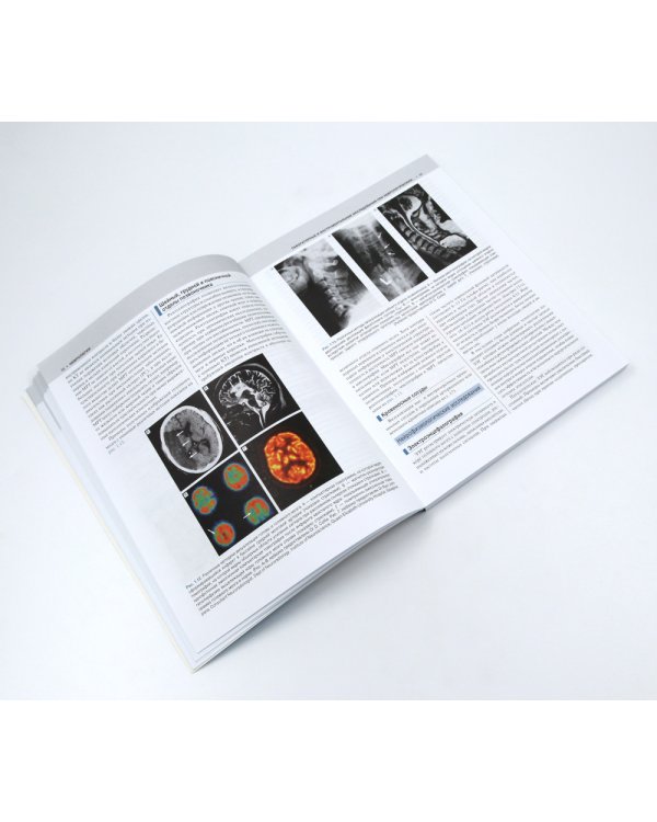 Внутренние болезни по Дэвидсону: В 5 т. (комплект из 5-ти книг)