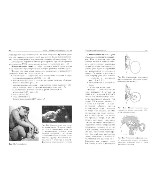 Детская неврология и нейрохирургия: Учебник. В 2 т. Т. 2