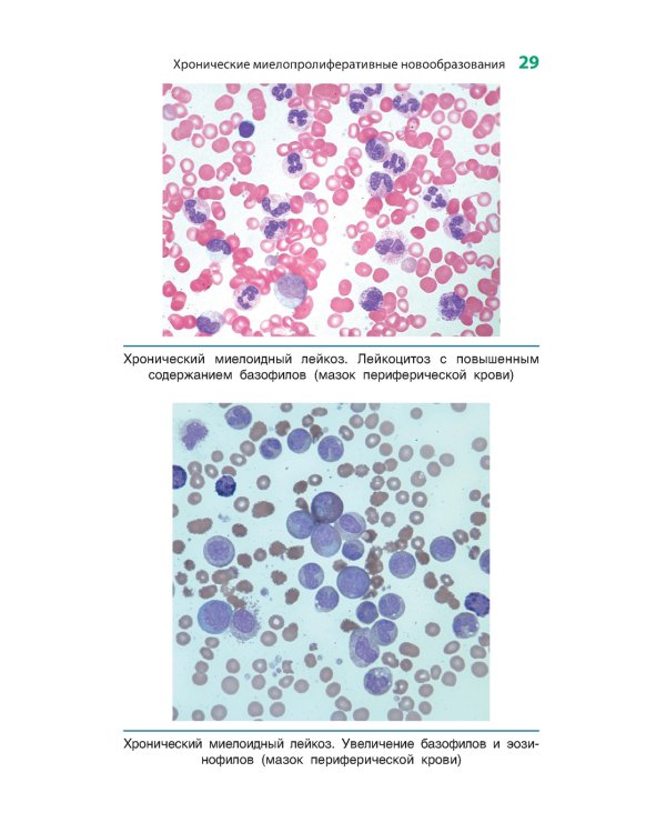 Карманный справочник по диагностической гематопатологии