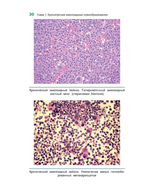 Карманный справочник по диагностической гематопатологии