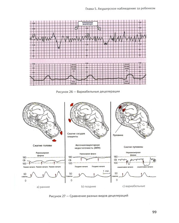 Классическое домашнее акушерство