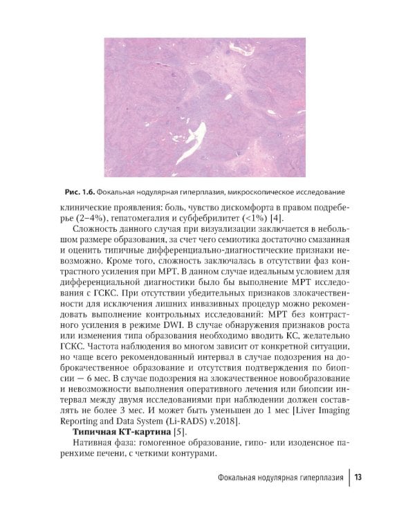 Трудности интерпретации данных КТ и МРТ: печень