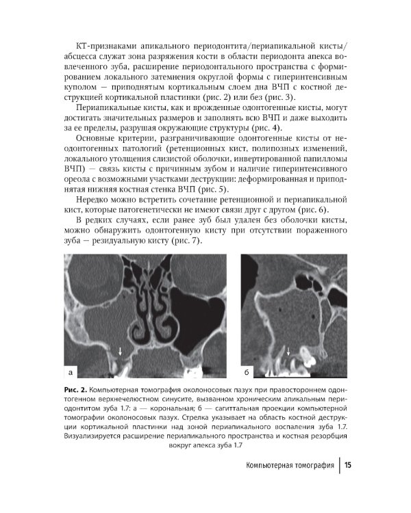 Современные аспекты диагностики и лечения одонтогенного верхнечелюстного синусита: руководство для врачей