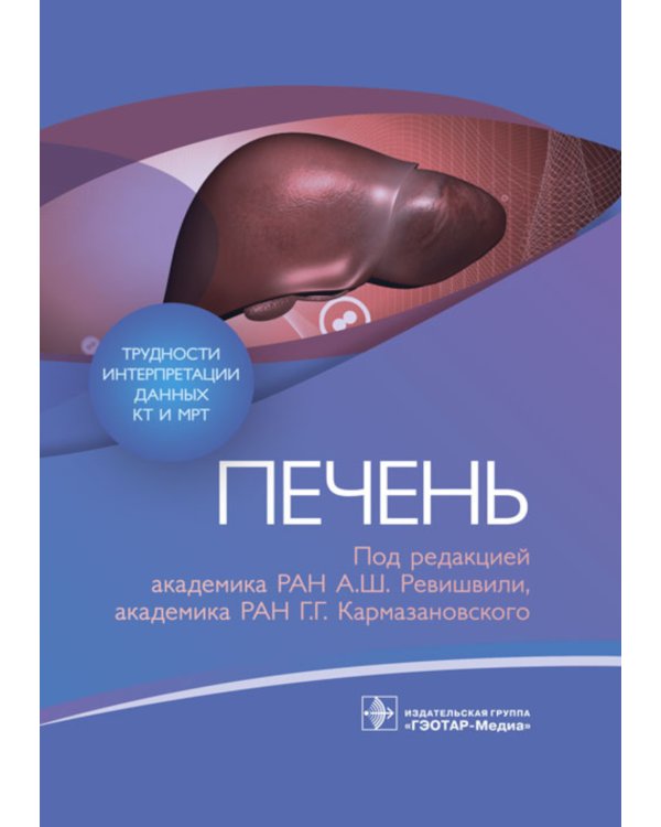 Трудности интерпретации данных КТ и МРТ: печень