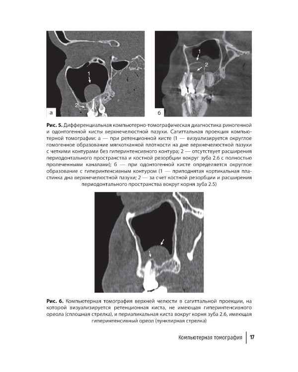 Современные аспекты диагностики и лечения одонтогенного верхнечелюстного синусита: руководство для врачей