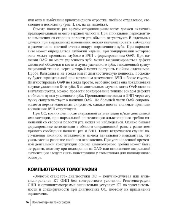 Современные аспекты диагностики и лечения одонтогенного верхнечелюстного синусита: руководство для врачей
