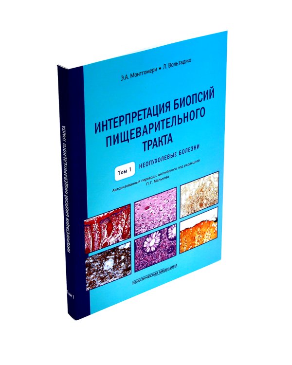 Интерпретация биопсий пищеварительного тракта: В 2-х т. (комплект в 2-х книг)