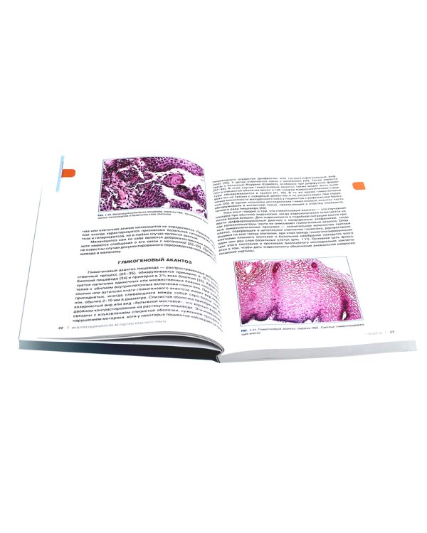 Интерпретация биопсий пищеварительного тракта: В 2-х т. (комплект в 2-х книг)