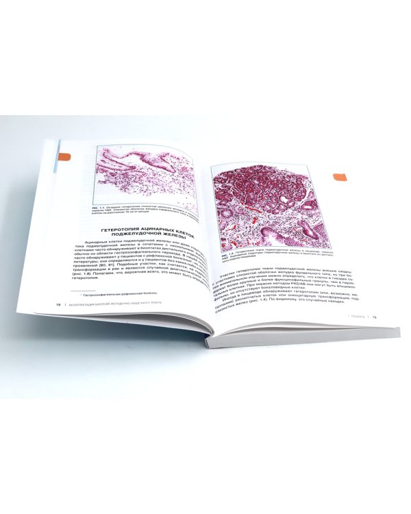 Интерпретация биопсий пищеварительного тракта: В 2-х т. (комплект в 2-х книг)