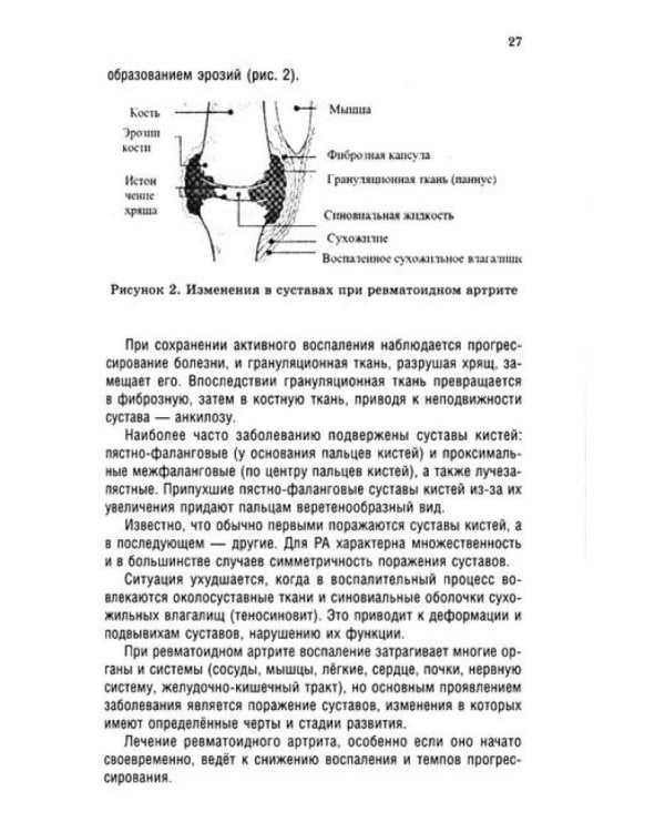 Ревматоидный артрит. Ч. 1: Современные представления о диогностике, лечении, профилактике